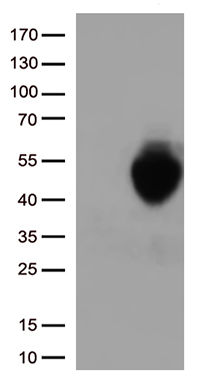 PD-L1 Antibody