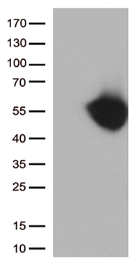 PD-L1 Antibody