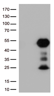 PD-L1 Antibody