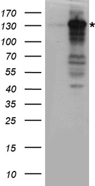 PD-L1 Antibody