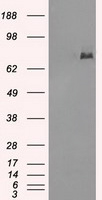PD-L1 Antibody