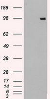 PD-L1 Antibody