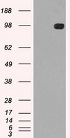 PD-L1 Antibody
