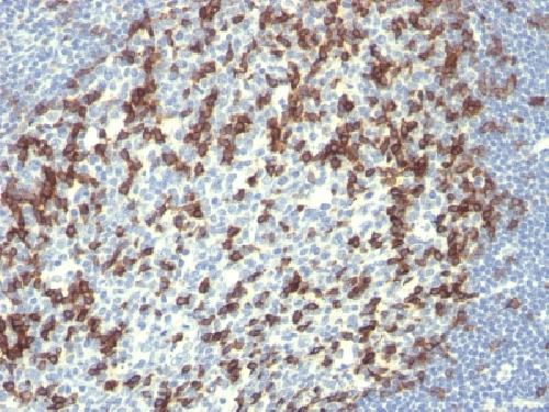 PDCD1 / PD1 / CD279 (Programmed Cell Death 1) Antibody