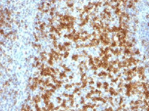 PDCD1 / PD1 / CD279 (Programmed Cell Death 1) Antibody