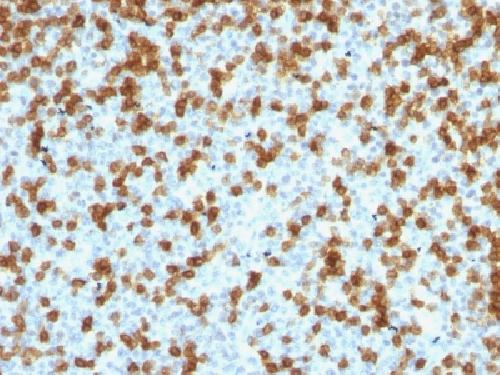 Recombinant PDCD1 / PD1 / CD279 (Programmed Cell Death 1) Antibody