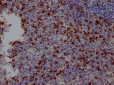PDCD1 Antibody