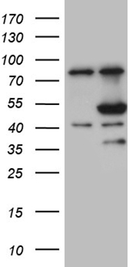 PDCD1 Antibody