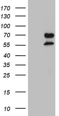 PD1 Antibody