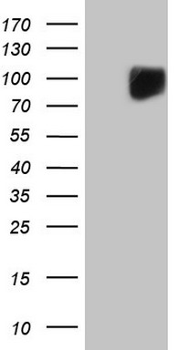 PD1 Antibody