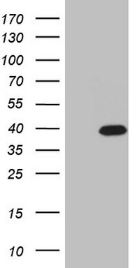 PD1 Antibody