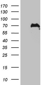 PD1 Antibody