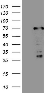 PD1 Antibody