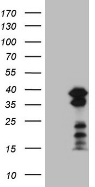 PD1 Antibody