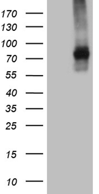 PD1 Antibody