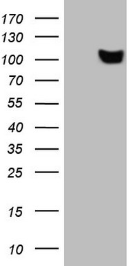 PD1 Antibody