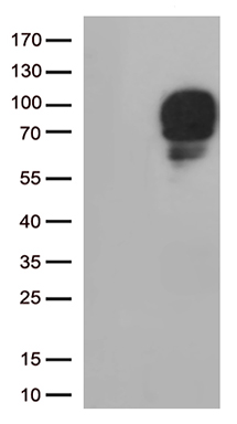 PD1 Antibody