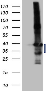 PDCD1 Antibody
