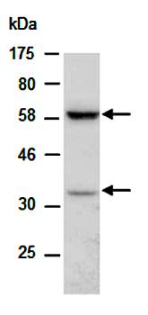 PD1 (M) Antibody, Rabbit Polyclonal