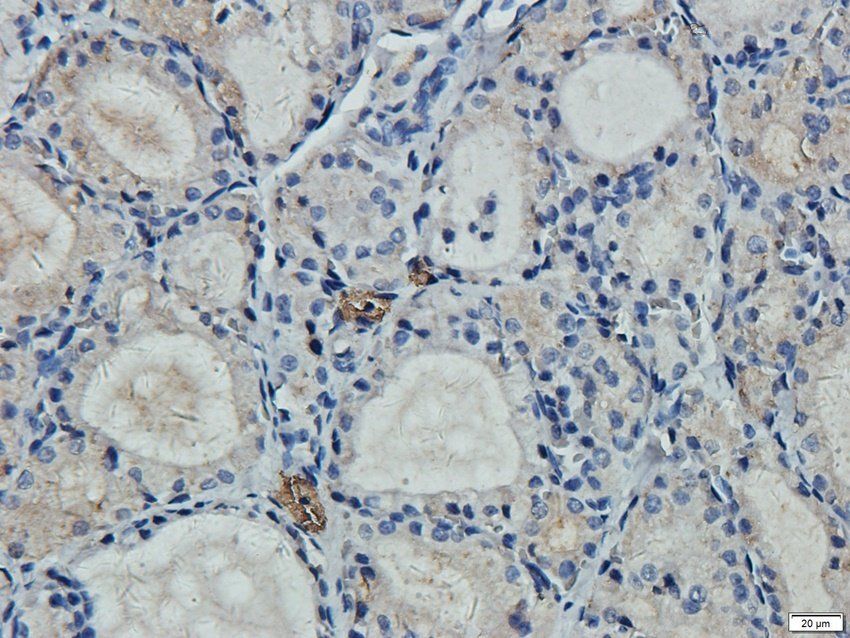 PD2R2 antibody