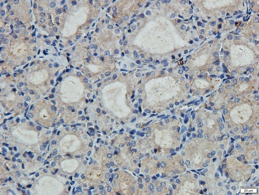 PD2R2 antibody