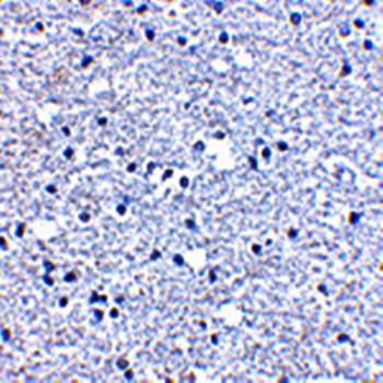 PD Antibody