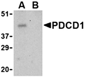 PD Antibody