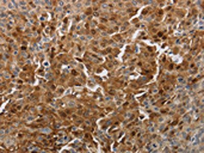 PDCD2 Antibody