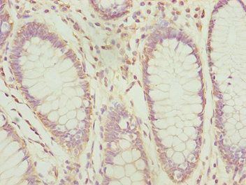 PDCD2L antibody