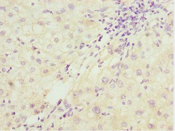 PDCD2L Antibody