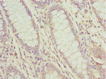 PDCD2L Antibody