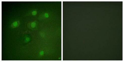 PDCD4 (Ab-457) Antibody