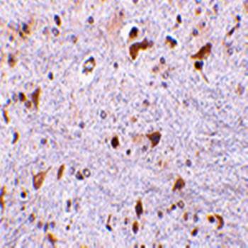 PDCD4 Rabbit Polyclonal Antibody