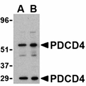 PDCD4 Rabbit Polyclonal Antibody