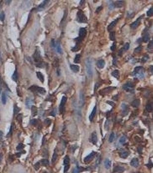 PDCD4 Rabbit Polyclonal Antibody