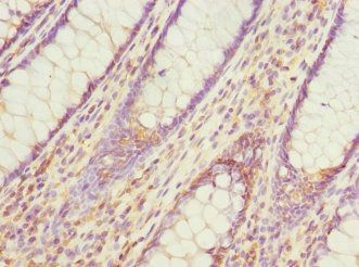 PDCD5 Antibody