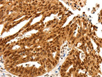 PDCD6 Antibody