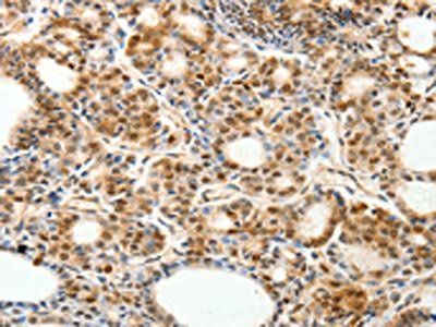 PDCD6 Antibody