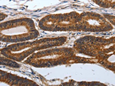PDCD7 Antibody