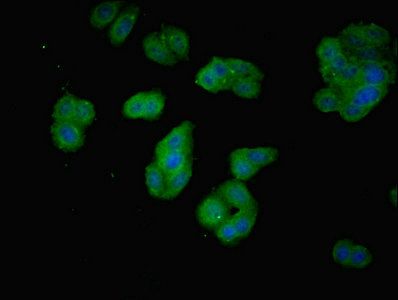 PDCL2 antibody