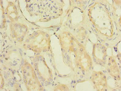 PDCL2 Antibody