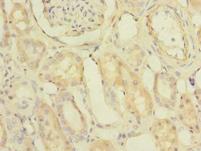 PDCL2 antibody