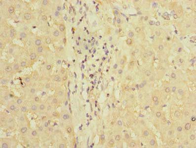 PDCL2 Antibody