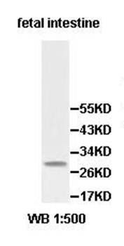 PDCL3 Rabbit Polyclonal Antibody