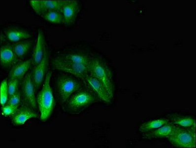 PDE11A antibody