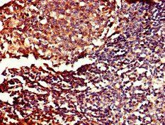 PDE11A Antibody