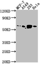 PDE1B antibody