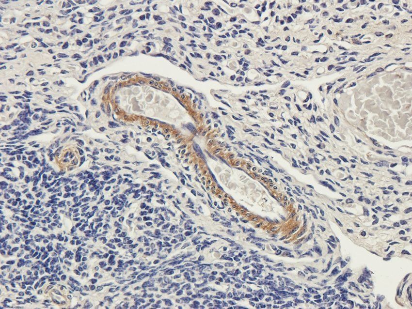 PDE1C antibody