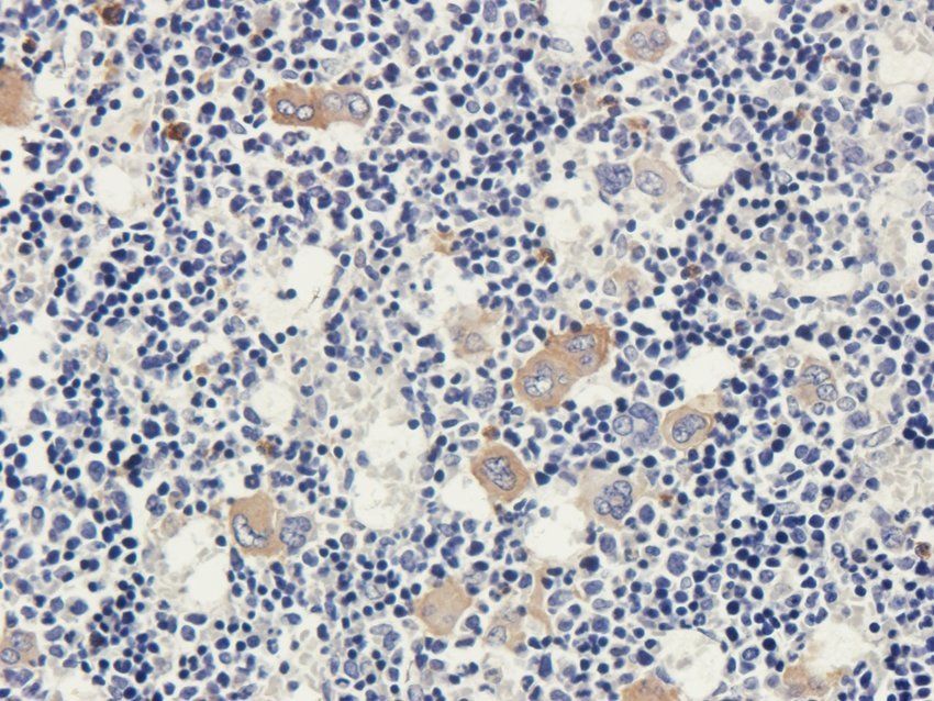 PDE1C antibody