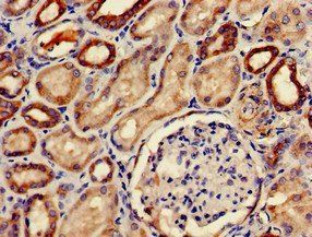 PDE2A Antibody